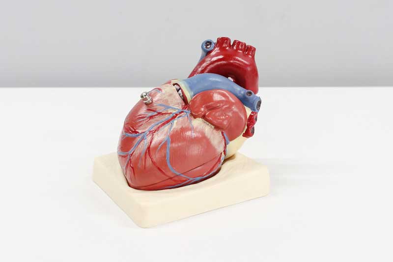 remote cardiac telemetry monitoring