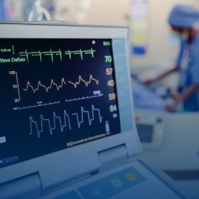 ecg electrocardiogram monitoring